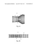 Transcatheter Valve Delivery Systems and Methods diagram and image