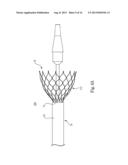 Transcatheter Valve Delivery Systems and Methods diagram and image