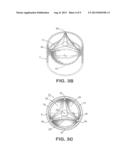 Prosthetic Tissue Valve diagram and image