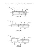 Invertible Tissue Valve And Method diagram and image