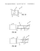 Invertible Tissue Valve And Method diagram and image