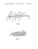 BLOOD PUMP FOR THE INVASIVE APPLICATION WITHIN A BODY OF A PATIENT diagram and image