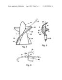 BLOOD PUMP FOR THE INVASIVE APPLICATION WITHIN A BODY OF A PATIENT diagram and image