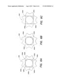 Accommodative Intraocular Lens Having a Haptic Plate diagram and image