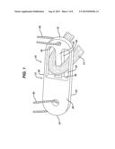 FLIPPING-TYPE GRAFT FIXATION DEVICE AND METHOD diagram and image