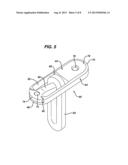 FLIPPING-TYPE GRAFT FIXATION DEVICE AND METHOD diagram and image