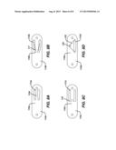 FLIPPING-TYPE GRAFT FIXATION DEVICE AND METHOD diagram and image