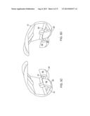 SYSTEMS AND METHODS FOR PROVIDING A MODULAR FEMORAL COMPONENT diagram and image