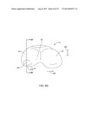 SYSTEMS AND METHODS FOR PROVIDING A MODULAR FEMORAL COMPONENT diagram and image