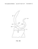 SYSTEMS AND METHODS FOR PROVIDING A MODULAR FEMORAL COMPONENT diagram and image