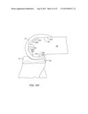 SYSTEMS AND METHODS FOR PROVIDING A MODULAR FEMORAL COMPONENT diagram and image