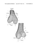 Total Knee Replacement Implant Based on Normal Anatomy and Kinematics diagram and image