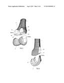 Total Knee Replacement Implant Based on Normal Anatomy and Kinematics diagram and image