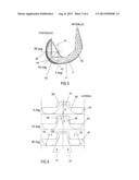 Total Knee Replacement Implant Based on Normal Anatomy and Kinematics diagram and image