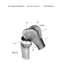 Total Knee Replacement Implant Based on Normal Anatomy and Kinematics diagram and image