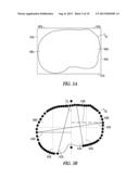 TIBIAL BASEPLATES FOR SPECIAL PATIENT POPULATIONS diagram and image