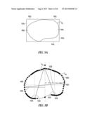 TIBIAL BASEPLATES FOR SPECIAL PATIENT POPULATIONS diagram and image