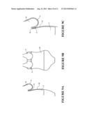 GARMENT FOR SUPPORTING A WEARER S BREASTS diagram and image