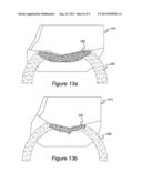 BLAST-RESISTANT VEHICLE HULL diagram and image