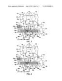 CAM TORQUE ACTUATED - TORSIONAL ASSIST PHASER diagram and image