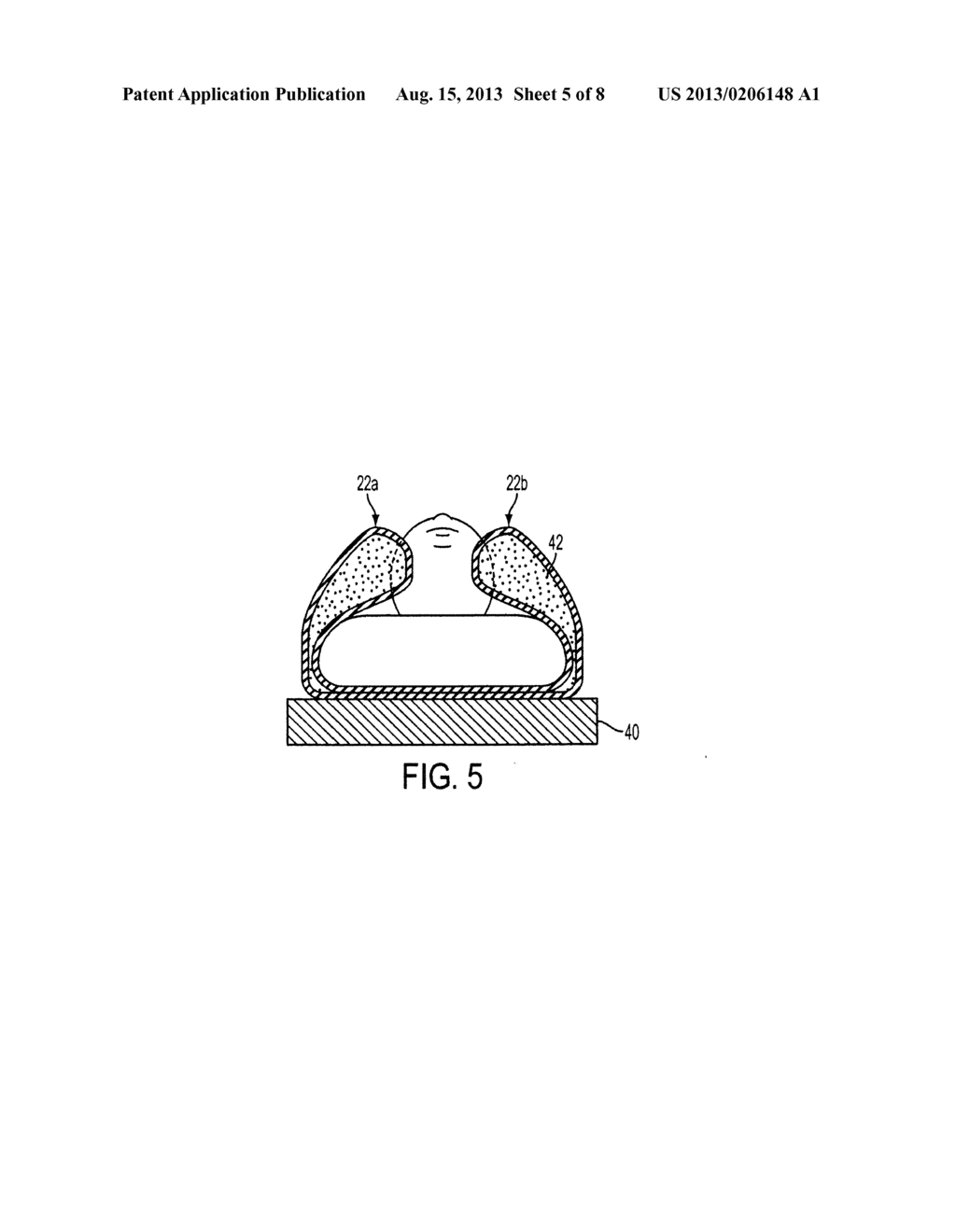 SURGICAL POSITIONING SYSTEM - diagram, schematic, and image 06