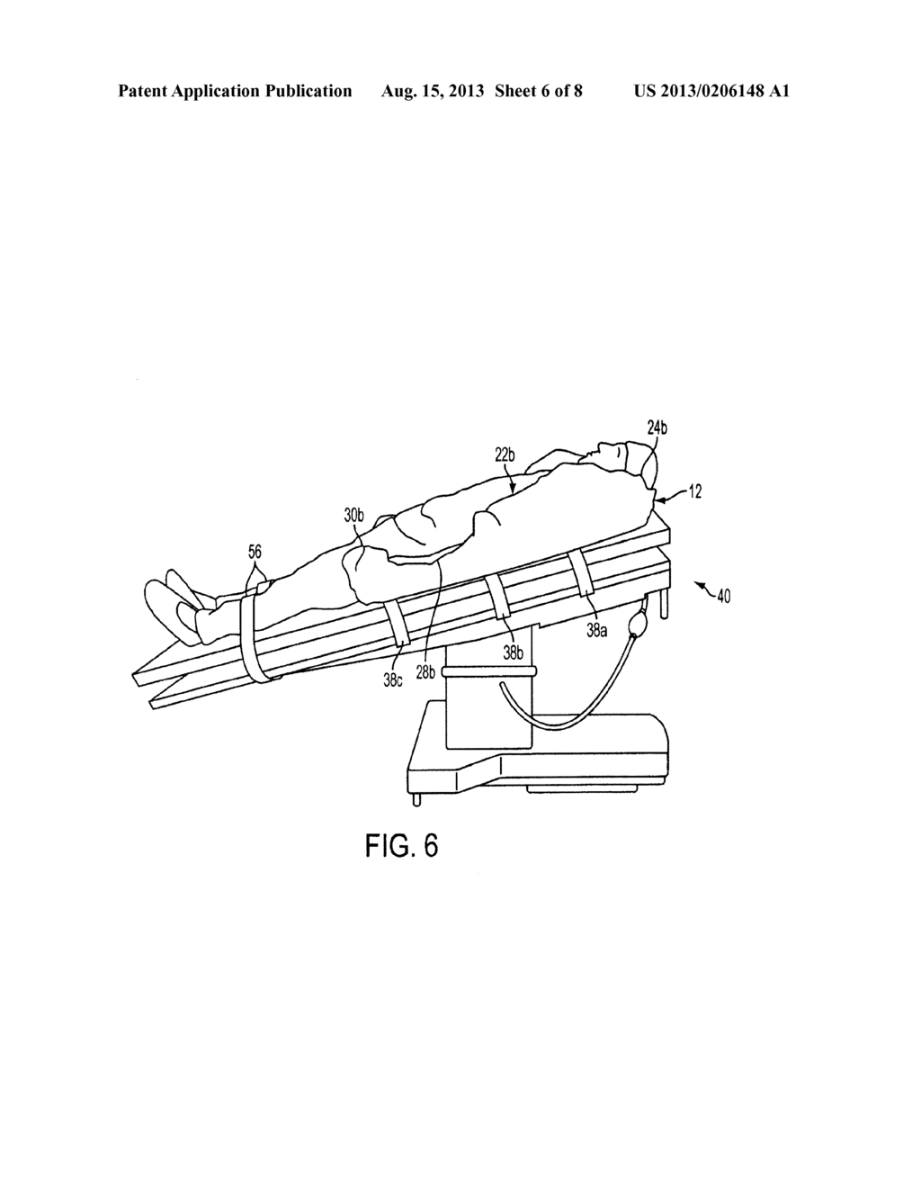 SURGICAL POSITIONING SYSTEM - diagram, schematic, and image 07