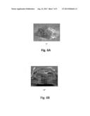 METHOD AND DEVICE FOR FABRICATING A PATIENT-SPECIFIC IMPLANT diagram and image