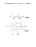 METHOD AND DEVICE FOR FABRICATING A PATIENT-SPECIFIC IMPLANT diagram and image