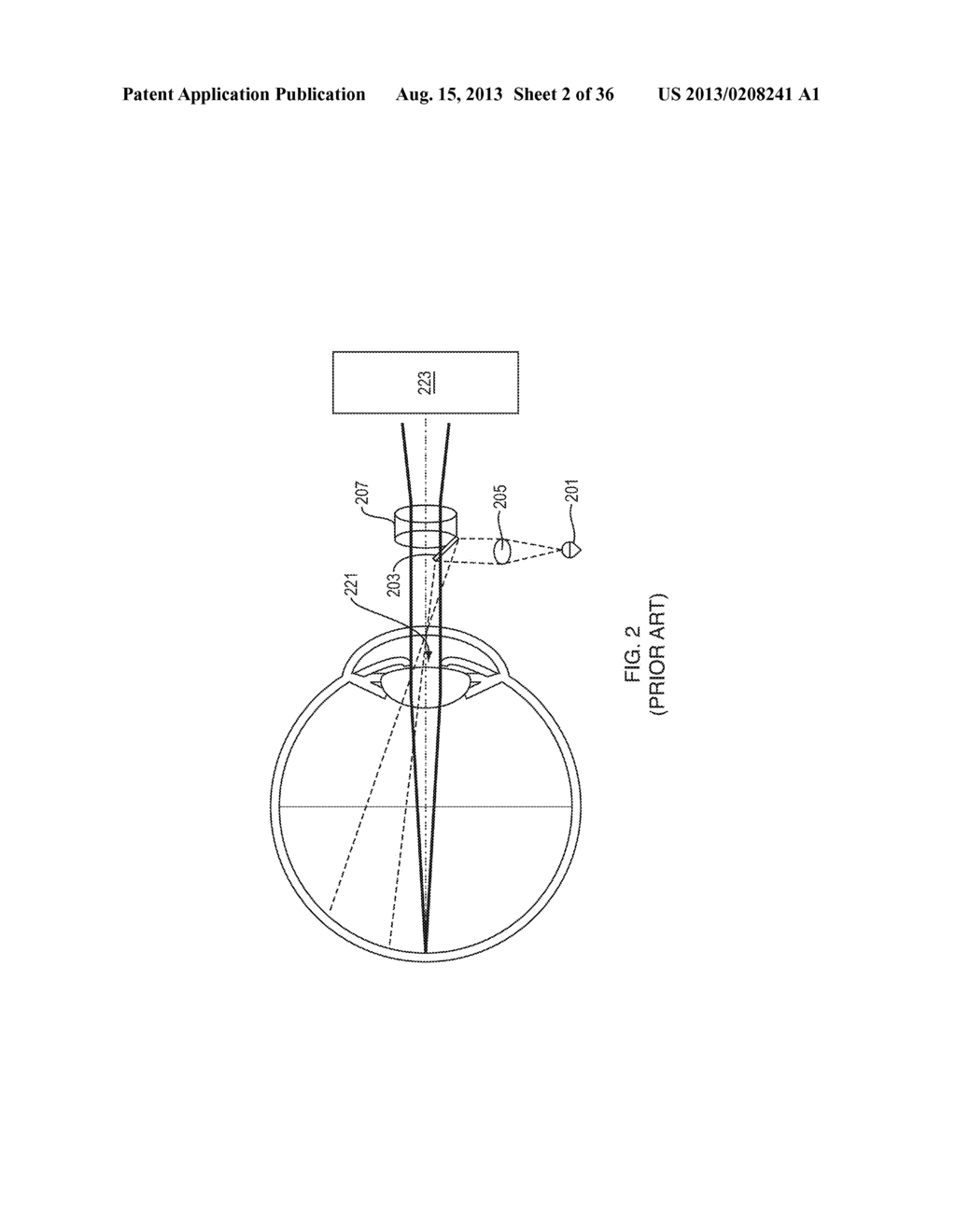 Methods and Apparatus for Retinal Imaging - diagram, schematic, and image 03