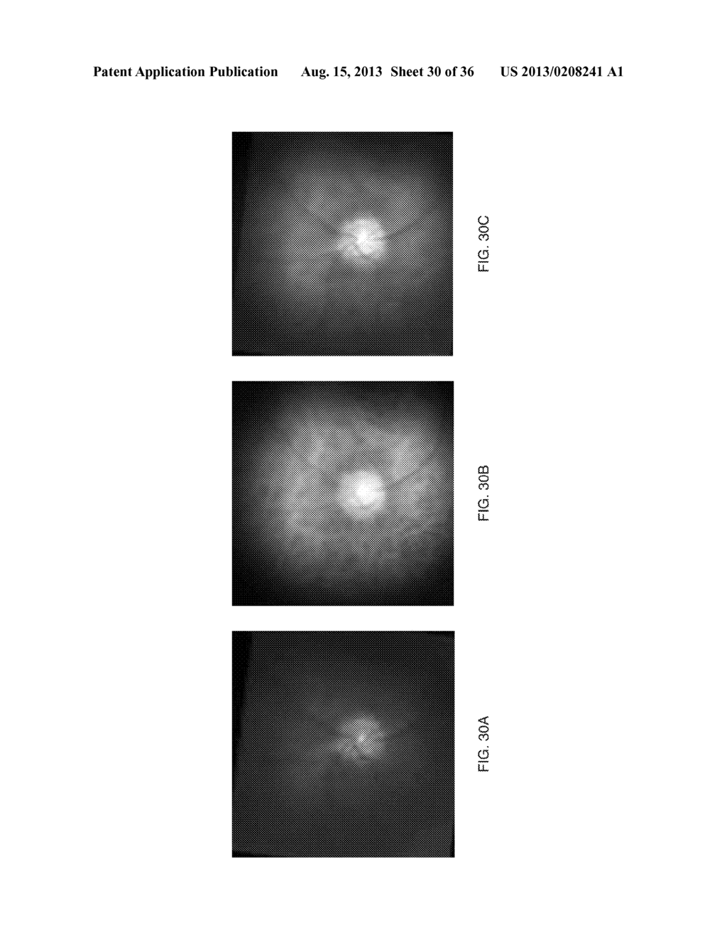 Methods and Apparatus for Retinal Imaging - diagram, schematic, and image 31