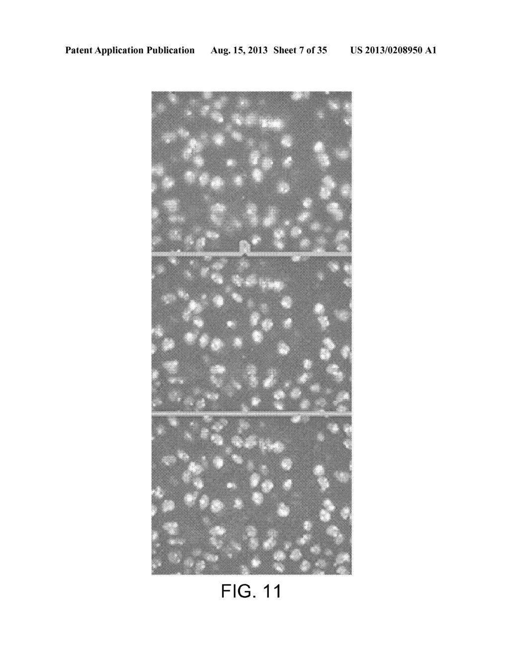 Automatic Image Analysis and Quantification for Fluorescence in situ     Hybridization - diagram, schematic, and image 08