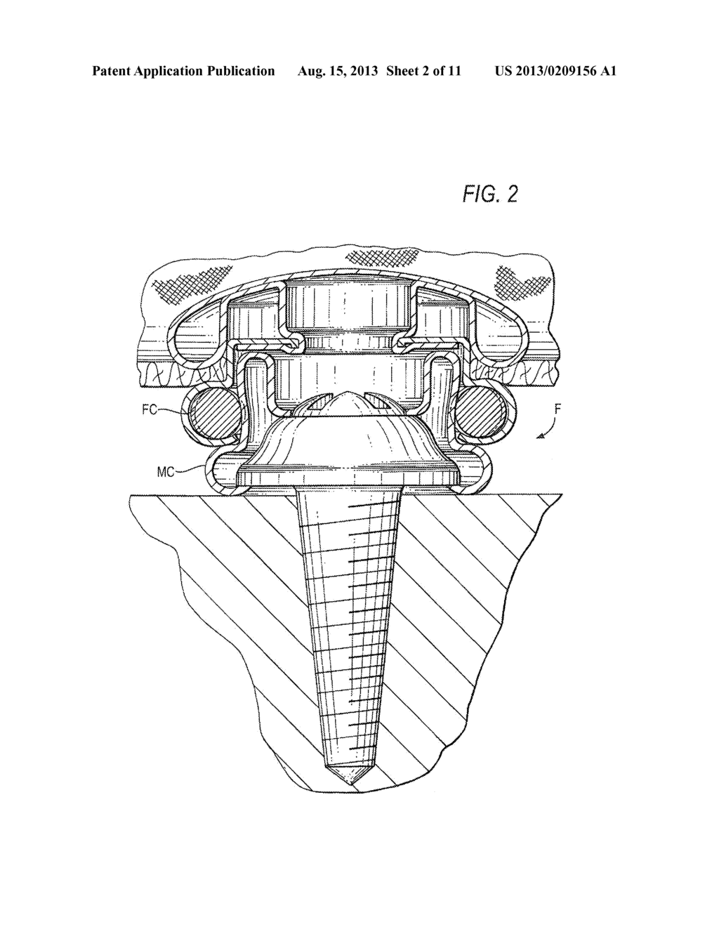 MAINTENANCE DEVICE FOR FASTENERS - diagram, schematic, and image 03