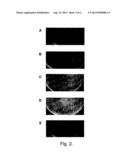 BACTERIOPHAGE-CONTAINING THERAPEUTIC AGENTS diagram and image