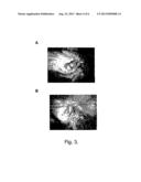 BACTERIOPHAGE-CONTAINING THERAPEUTIC AGENTS diagram and image