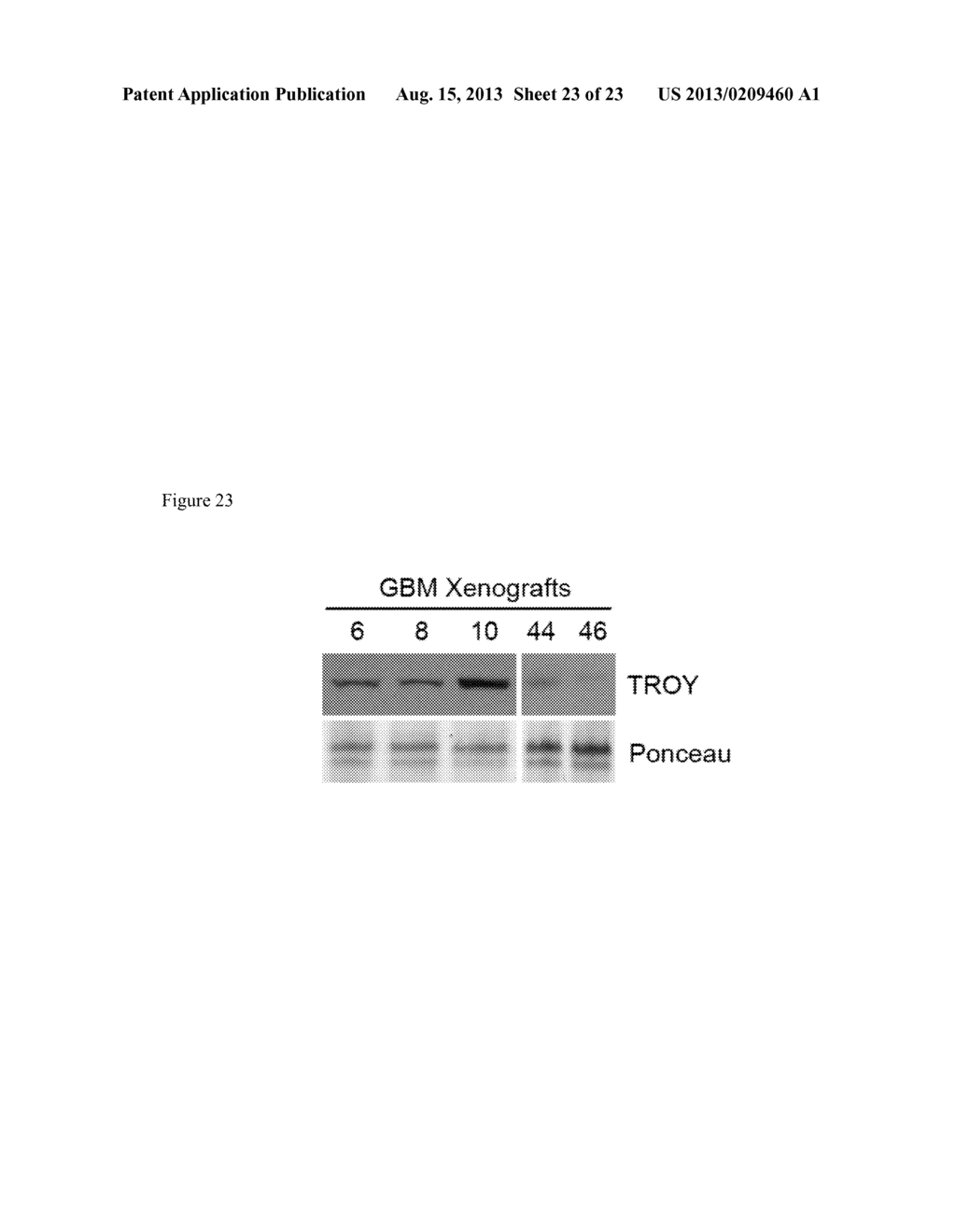 METHODS AND KITS USED IN IDENTIFYING GLIOBLASTOMA - diagram, schematic, and image 24