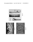 Drug Release from a Polymer-Controlled Local Antibiotic Delivery System     Using a Degradable Bone Graft diagram and image