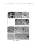 Drug Release from a Polymer-Controlled Local Antibiotic Delivery System     Using a Degradable Bone Graft diagram and image