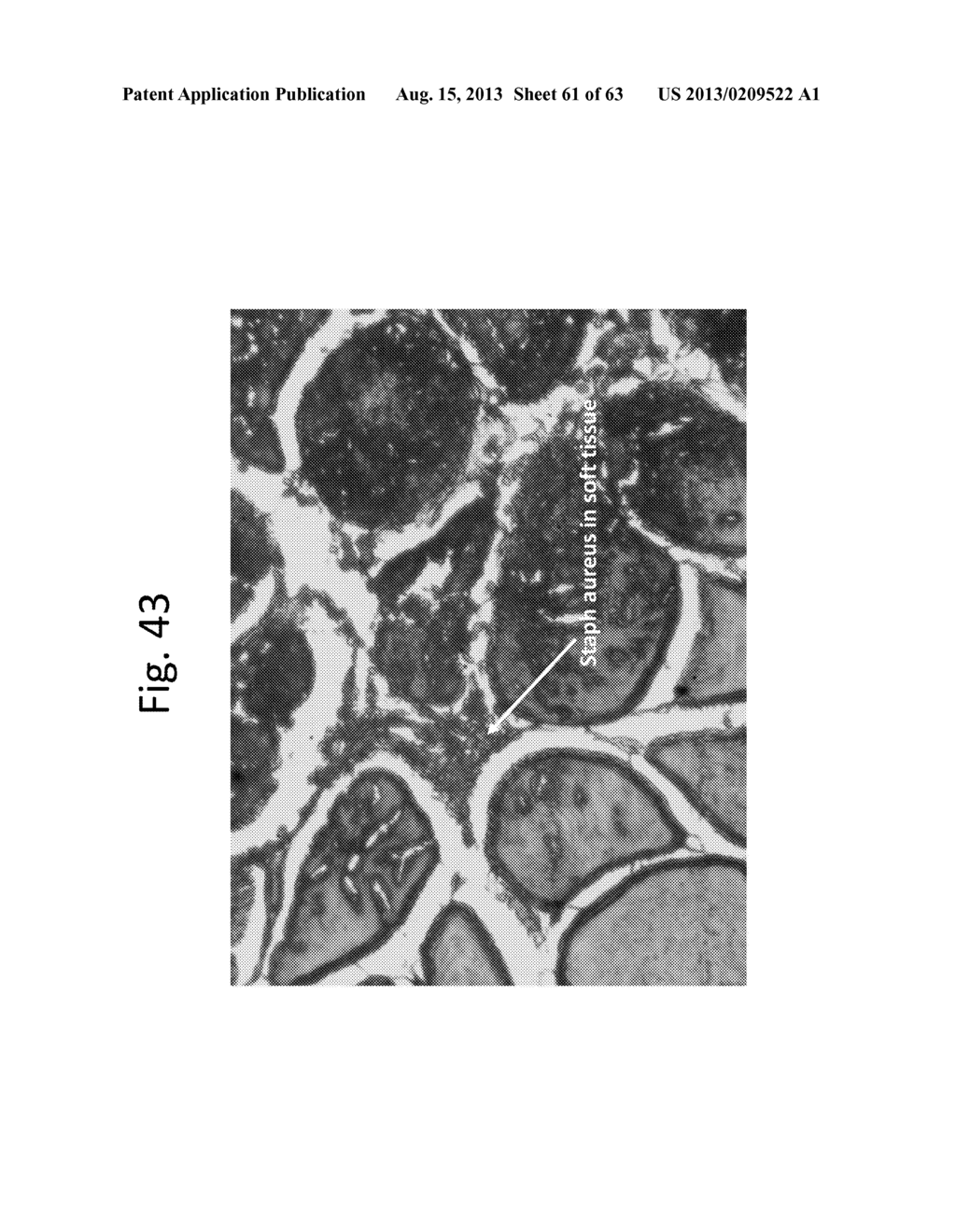 Drug Release from a Polymer-Controlled Local Antibiotic Delivery System     Using a Degradable Bone Graft - diagram, schematic, and image 62