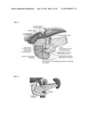 Buffered Upper GI Absorption Promoter diagram and image