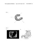 Buffered Upper GI Absorption Promoter diagram and image