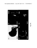 KINETIC STABILIZATION OF MAGNESIUM HYDRIDE diagram and image