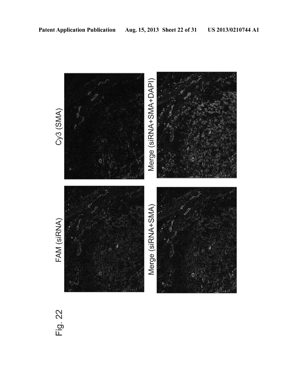 TARGETING AGENT FOR CANCER CELL OR CANCER-ASSOCIATED FIBROBLAST - diagram, schematic, and image 23