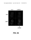 METHOD OF IDENTIFYING TRIPLE NEGATIVE BREAST CANCER diagram and image