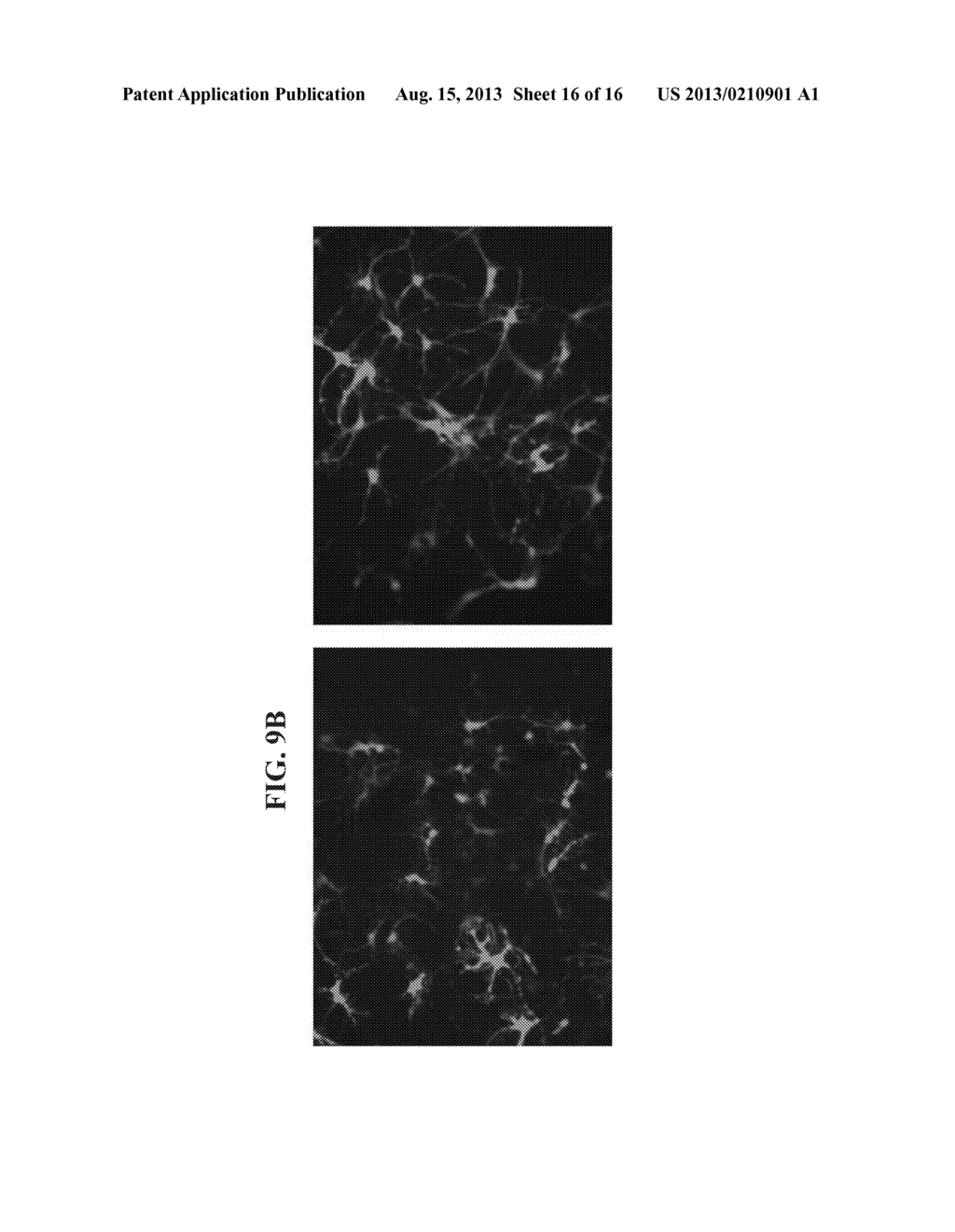 METHOD OF TREATING NEURODEGENERATIVE DISEASES - diagram, schematic, and image 17