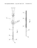 ENHANCED ABLATION APPARATUS diagram and image