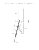 ENHANCED ABLATION APPARATUS diagram and image