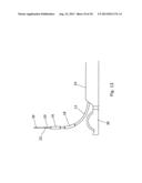 ENHANCED ABLATION APPARATUS diagram and image