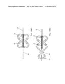 ENHANCED ABLATION APPARATUS diagram and image