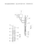 ENHANCED ABLATION APPARATUS diagram and image