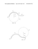 Methods And Devices For Minimally-Invasive Extraocular Delivery Of     Radiation To The Posterior Portion Of The Eye diagram and image